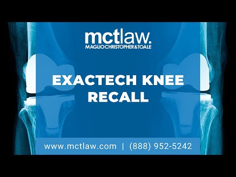 Knee Replacement Lawsuit Timing Under U.S. Legal Standards